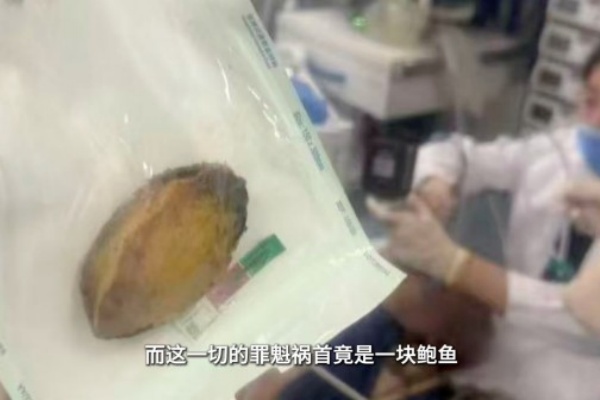 吃了块鲍鱼差点没命！家人有这种情况一定要注意——